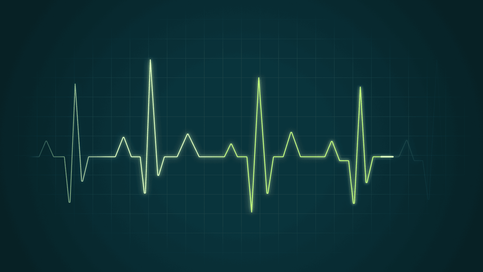 Why Kafka Platform Health Requires More Than Monitoring